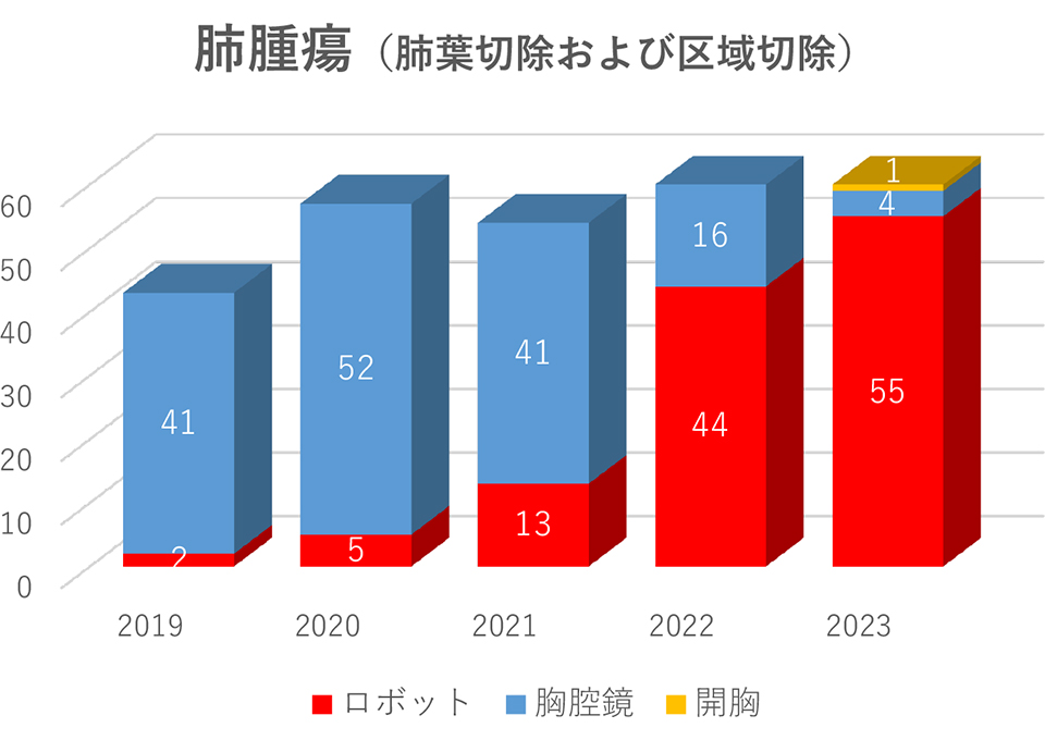 肺腫瘍